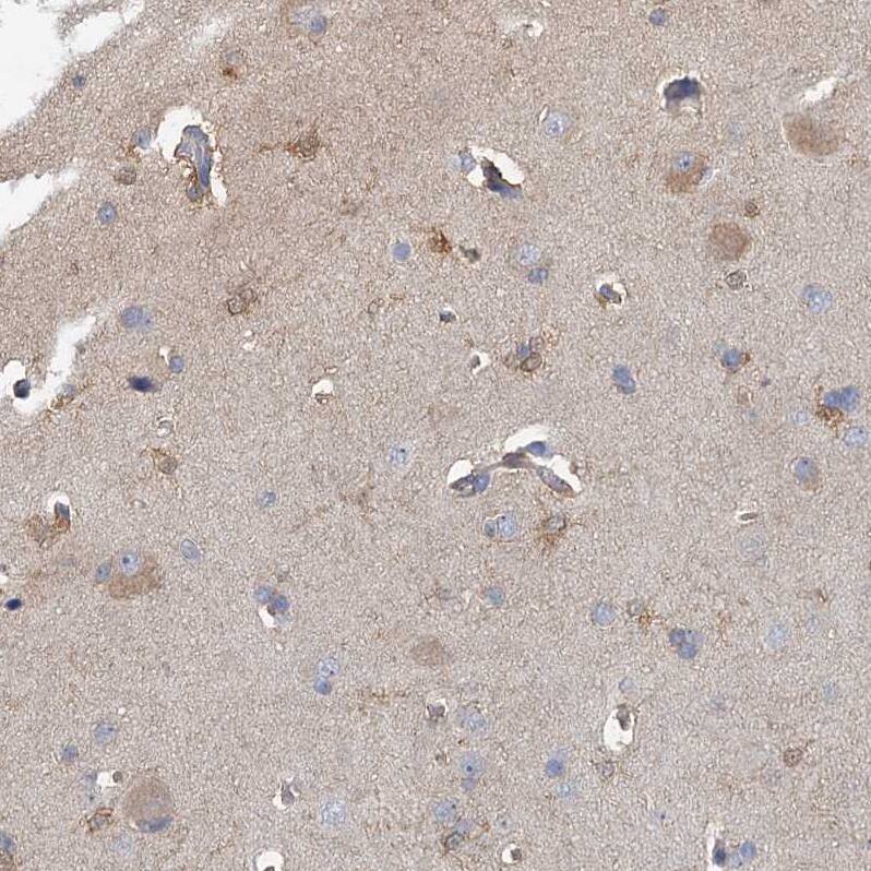GSTM3 Antibody - BSA Free Immunohistochemistry-Paraffin: GSTM3 Antibody - BSA Free [NBP1-83323]