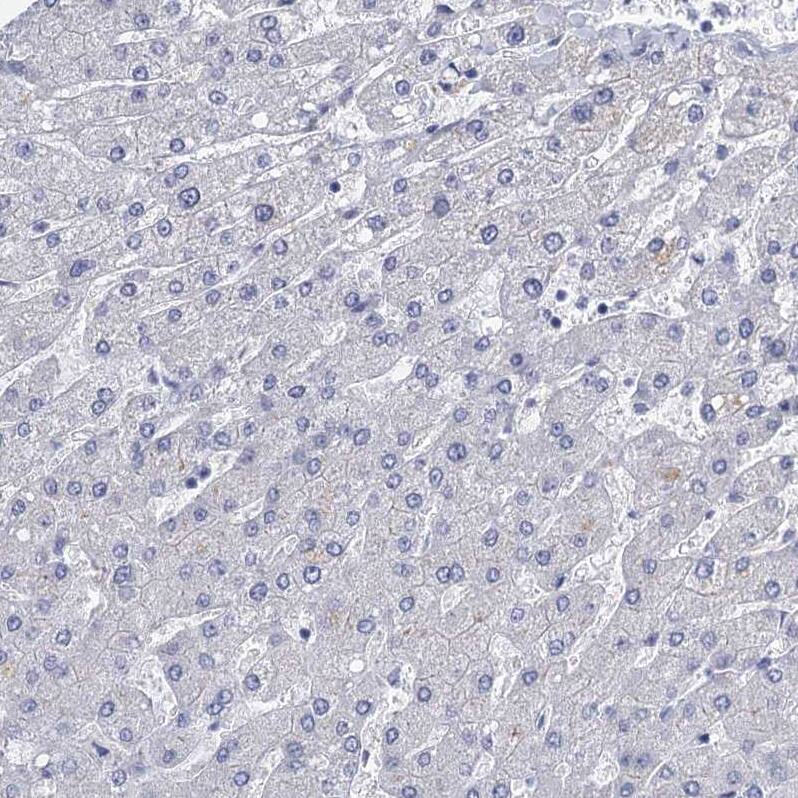 GSTM3 Antibody - BSA Free Immunohistochemistry-Paraffin: GSTM3 Antibody - BSA Free [NBP1-83323]