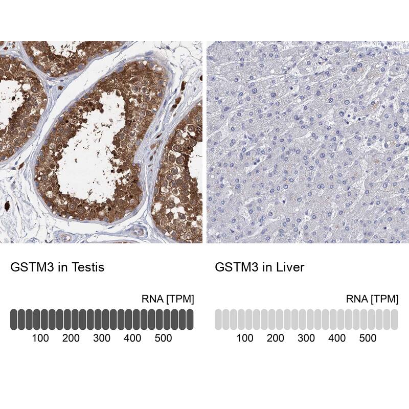 GSTM3 Antibody - BSA Free Immunohistochemistry-Paraffin: GSTM3 Antibody - BSA Free [NBP1-83323]