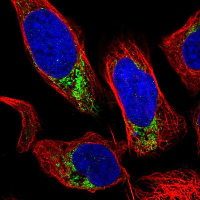 GRK6 Antibody - BSA Free Immunocytochemistry/ Immunofluorescence: GRK6 Antibody [NBP1-83334]