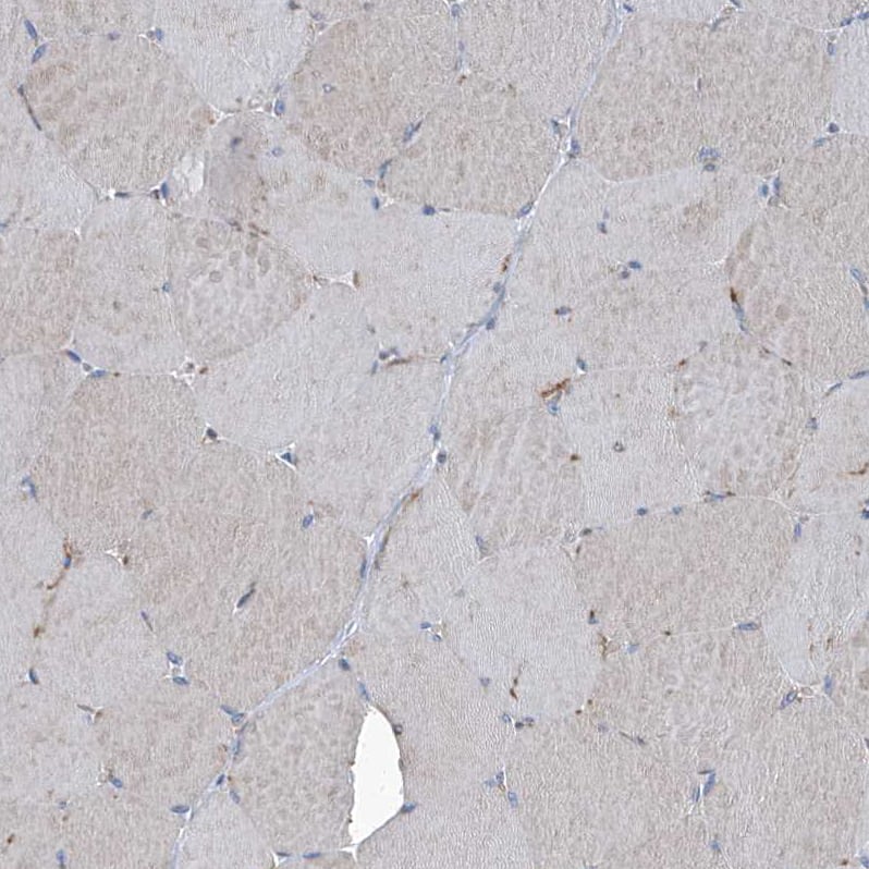 PIGH Antibody - BSA Free Immunohistochemistry-Paraffin: PIGH Antibody - BSA Free [NBP1-83342]