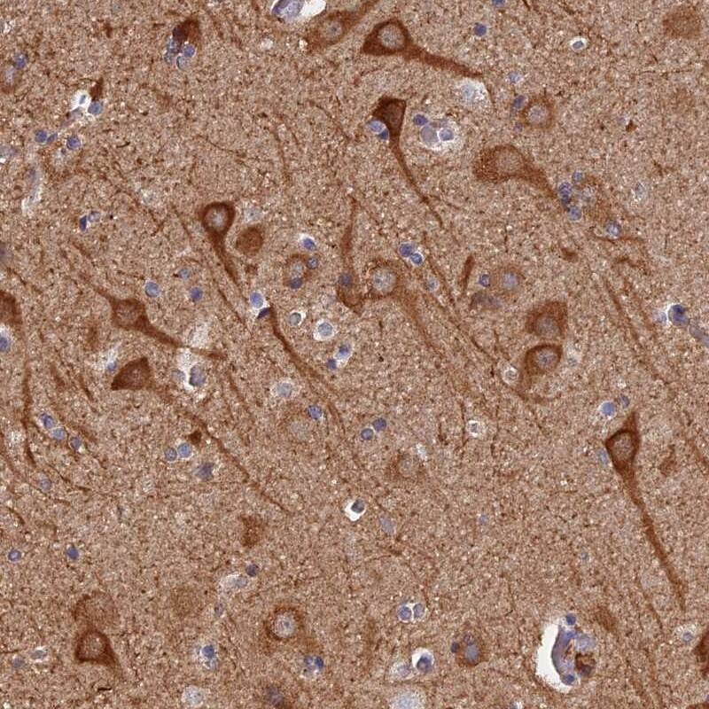PIGQ Antibody - BSA Free Immunohistochemistry-Paraffin: PIGQ Antibody [NBP1-83343]