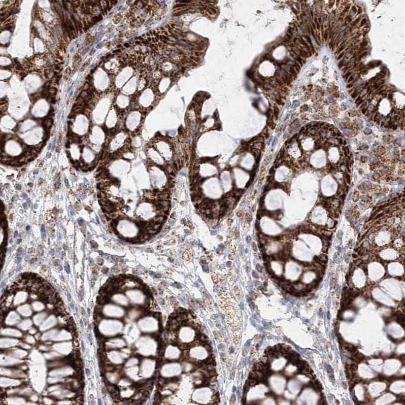LRPPRC Antibody - BSA Free Immunohistochemistry-Paraffin: LRPPRC Antibody - BSA Free [NBP1-83349]