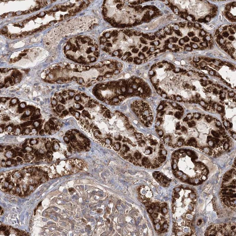 LRPPRC Antibody - BSA Free Immunohistochemistry-Paraffin: LRPPRC Antibody - BSA Free [NBP1-83349]