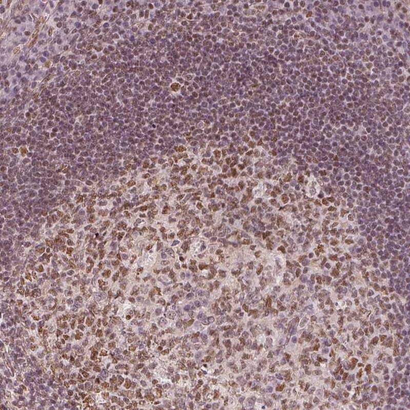 HDAC1 Antibody - BSA Free Immunohistochemistry-Paraffin: HDAC1 Antibody - BSA Free [NBP1-83350]