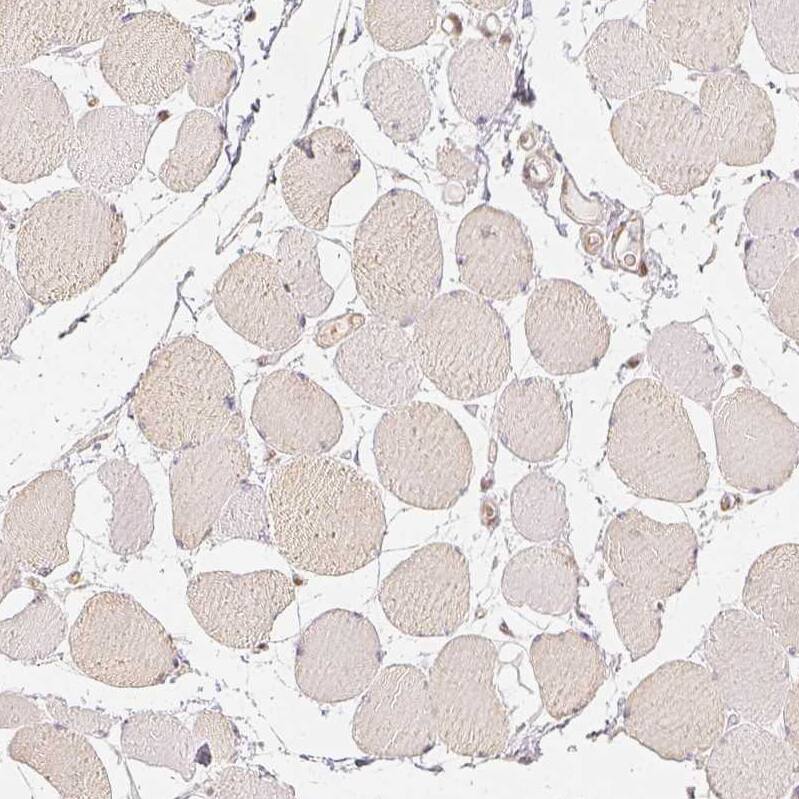 HDAC1 Antibody - BSA Free Immunohistochemistry-Paraffin: HDAC1 Antibody - BSA Free [NBP1-83350]