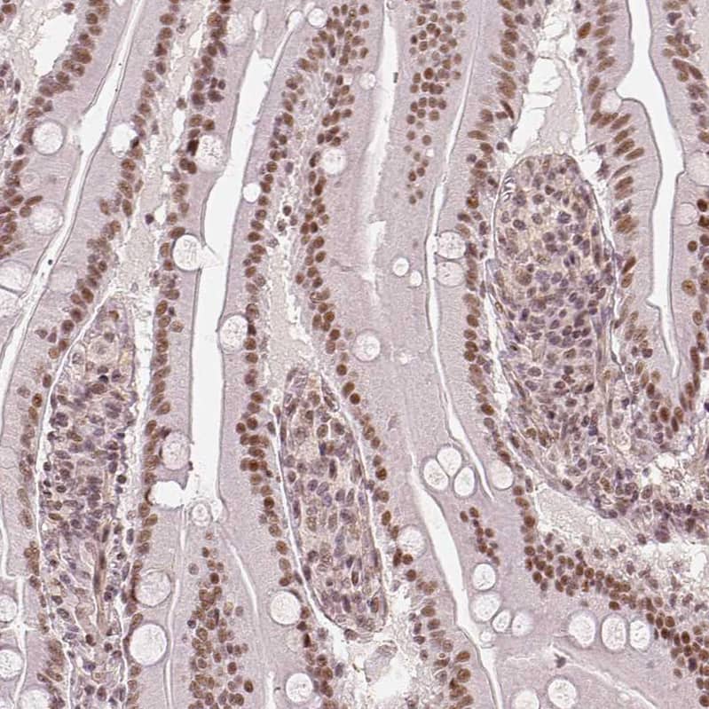 HDAC1 Antibody - BSA Free Immunohistochemistry-Paraffin: HDAC1 Antibody - BSA Free [NBP1-83350]