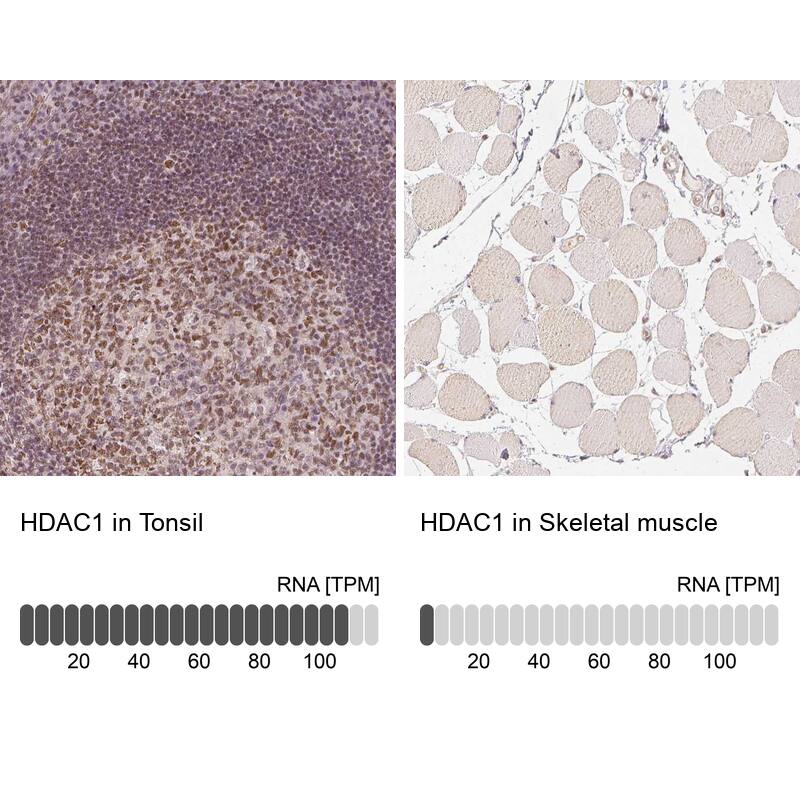 HDAC1 Antibody - BSA Free Immunohistochemistry-Paraffin: HDAC1 Antibody - BSA Free [NBP1-83350]