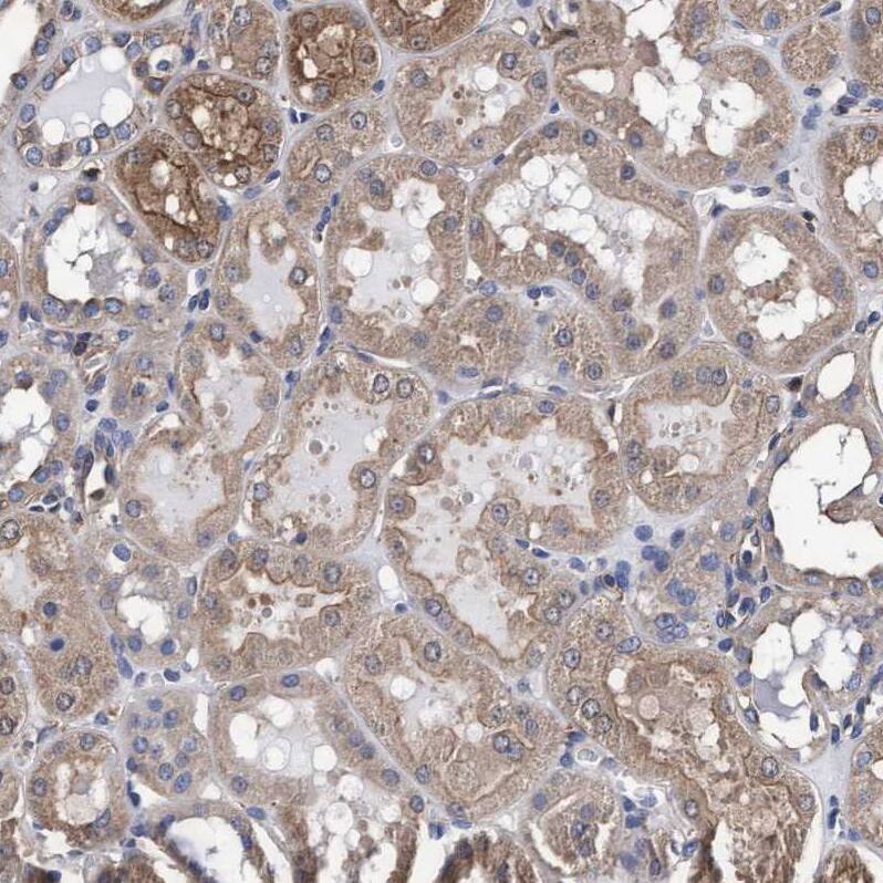 GRHPR Antibody - BSA Free Immunohistochemistry-Paraffin: GRHPR Antibody - BSA Free [NBP1-83359]