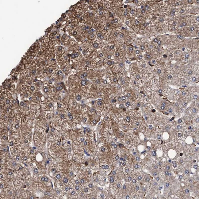 GRHPR Antibody - BSA Free Immunohistochemistry-Paraffin: GRHPR Antibody - BSA Free [NBP1-83359]