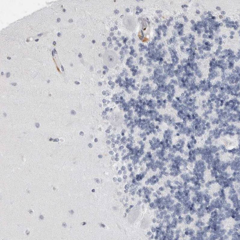 GILT/IFI30 Antibody - BSA Free Immunohistochemistry-Paraffin: GILT/IFI30 Antibody - BSA Free [NBP1-83366]