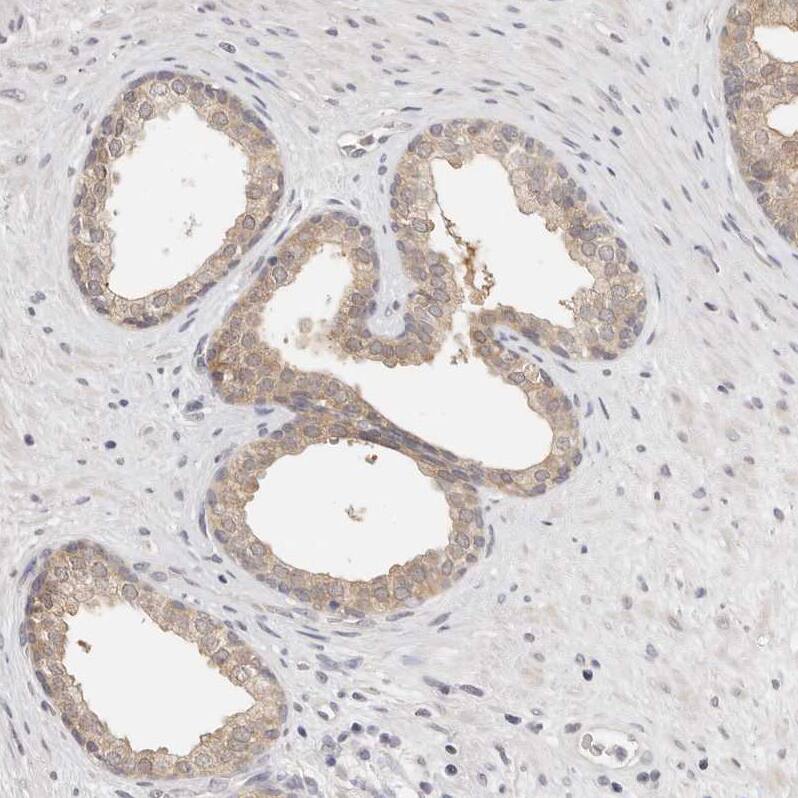 GGPS1 Antibody - BSA Free Immunohistochemistry-Paraffin: GGPS1 Antibody - BSA Free [NBP1-83368]