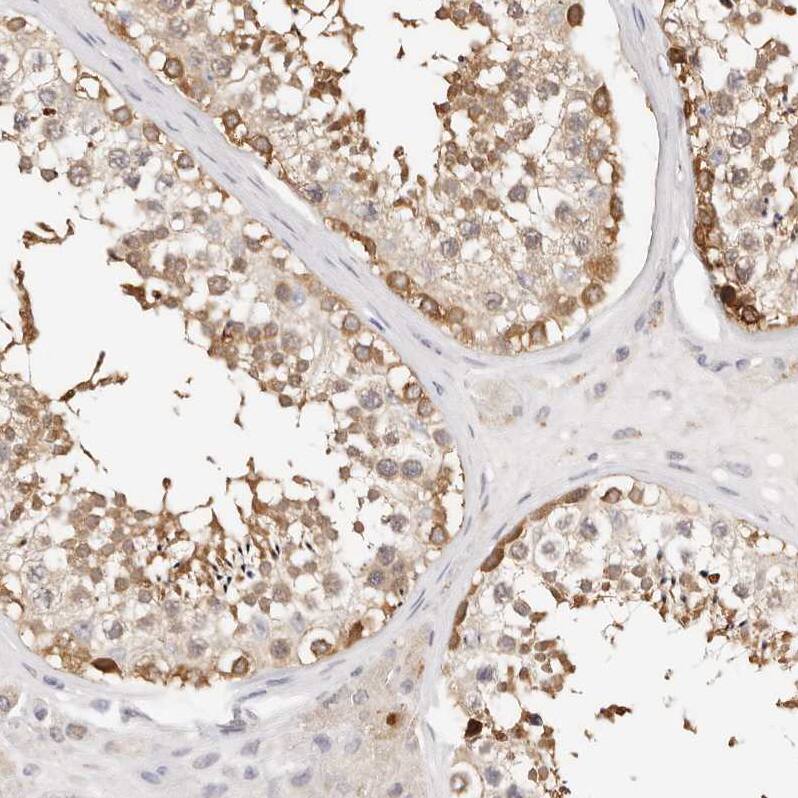 GGPS1 Antibody - BSA Free Immunohistochemistry-Paraffin: GGPS1 Antibody - BSA Free [NBP1-83368]