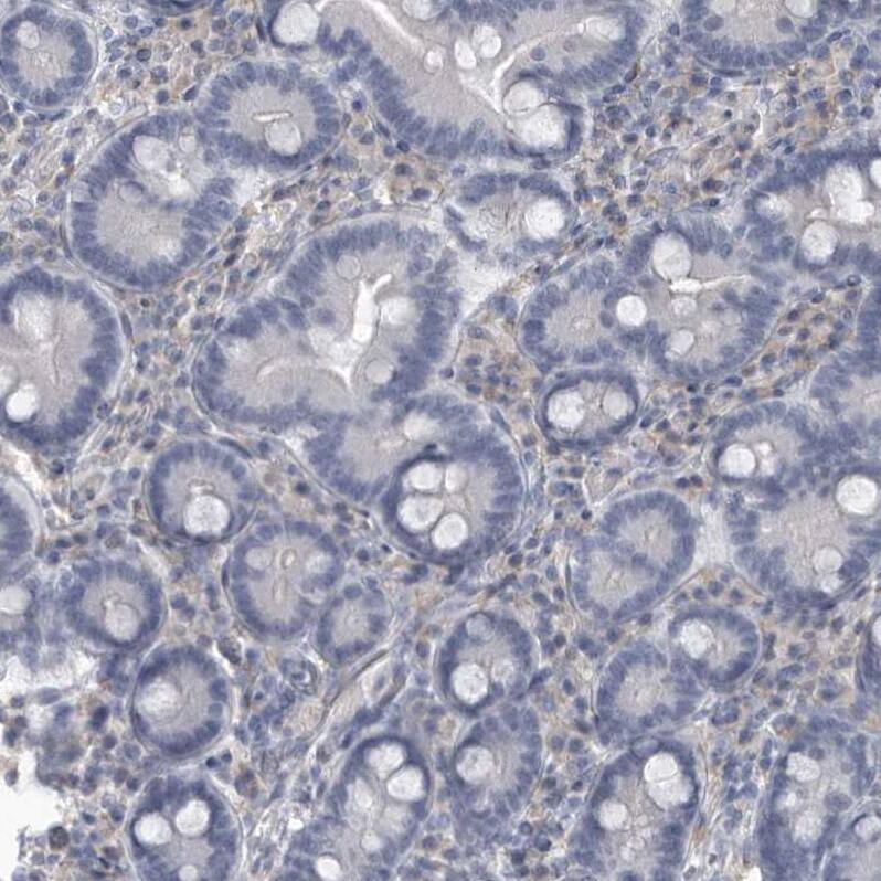 ARHGEF10 Antibody - BSA Free Immunohistochemistry-Paraffin: ARHGEF10 Antibody - BSA Free [NBP1-83373]