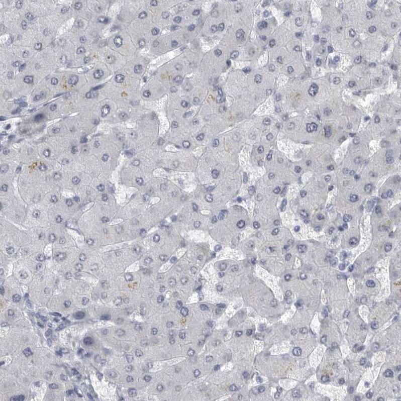 ARHGEF10 Antibody - BSA Free Immunohistochemistry-Paraffin: ARHGEF10 Antibody - BSA Free [NBP1-83373]