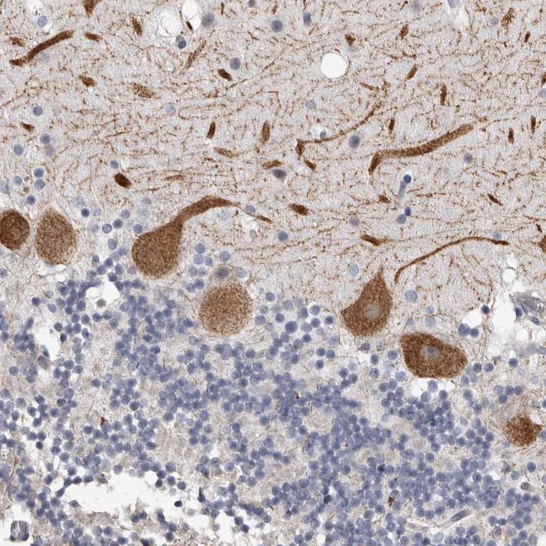 ARHGEF10 Antibody - BSA Free Immunohistochemistry-Paraffin: ARHGEF10 Antibody - BSA Free [NBP1-83373]