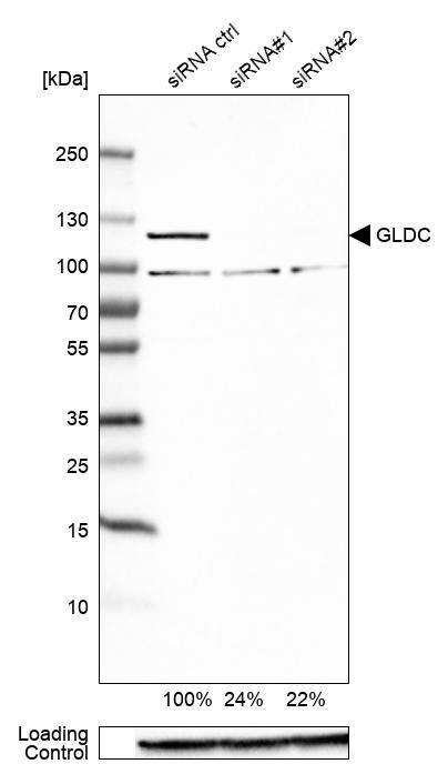 GLDC Antibody - BSA Free Western Blot: GLDC Antibody - BSA Free [NBP1-83374]