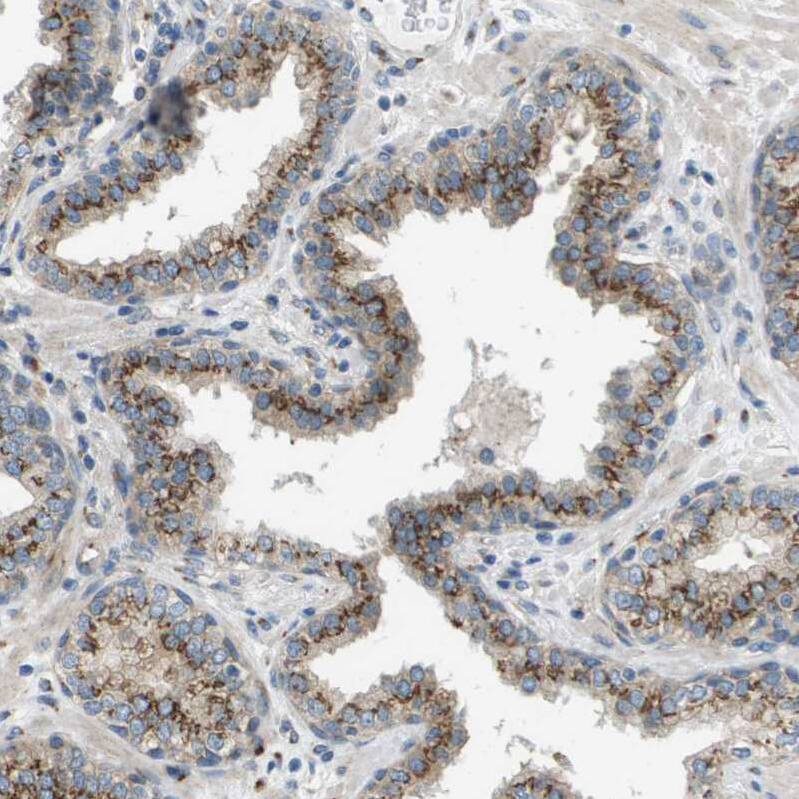 ACBD3 Antibody - BSA Free Immunohistochemistry-Paraffin: ACBD3 Antibody - BSA Free [NBP1-83379]