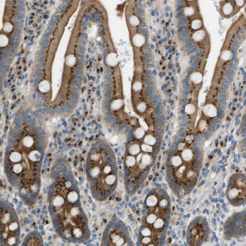 ACBD3 Antibody - BSA Free Immunohistochemistry-Paraffin: ACBD3 Antibody - BSA Free [NBP1-83379]