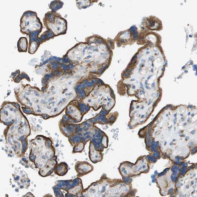 ACBD3 Antibody - BSA Free Immunohistochemistry-Paraffin: ACBD3 Antibody - BSA Free [NBP1-83379]