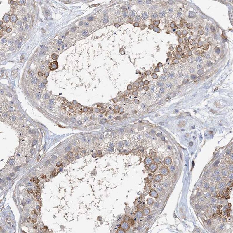 MAP4K5 Antibody - BSA Free Immunohistochemistry-Paraffin: MAP4K5 Antibody [NBP1-83385]