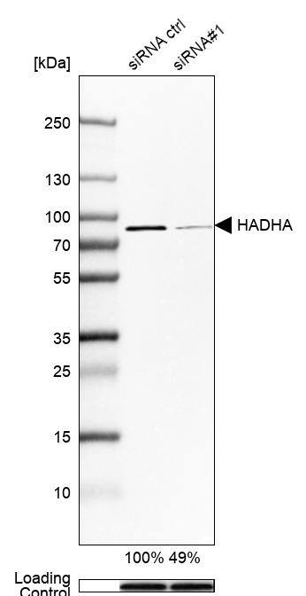 HADHA Antibody - BSA Free Western Blot: HADHA Antibody - BSA Free [NBP1-83387]