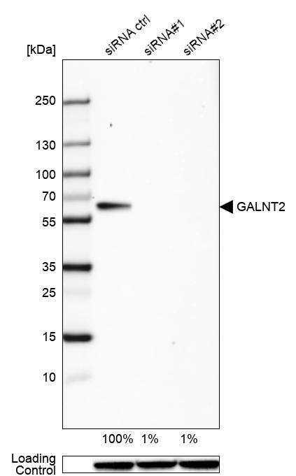 GALNT2 Antibody - BSA Free Western Blot: GALNT2 Antibody - BSA Free [NBP1-83394]