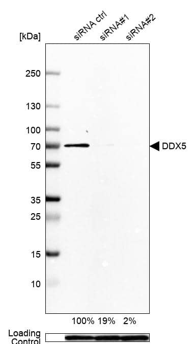 DDX5 Antibody - BSA Free Western Blot: DDX5 Antibody - BSA Free [NBP1-83406]
