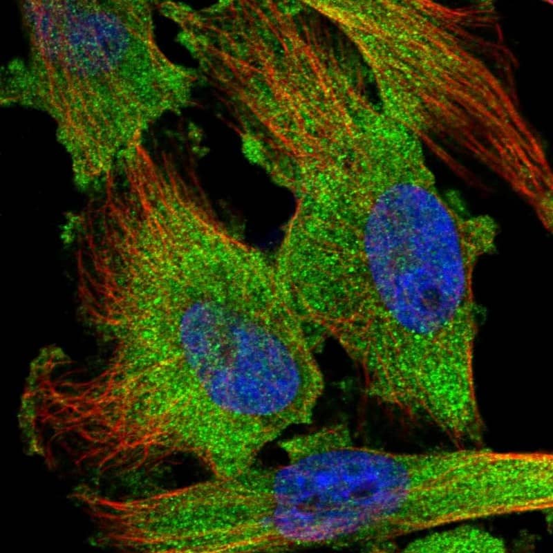 TSTA3 Antibody - BSA Free Immunocytochemistry/ Immunofluorescence: TSTA3 Antibody [NBP1-83408]