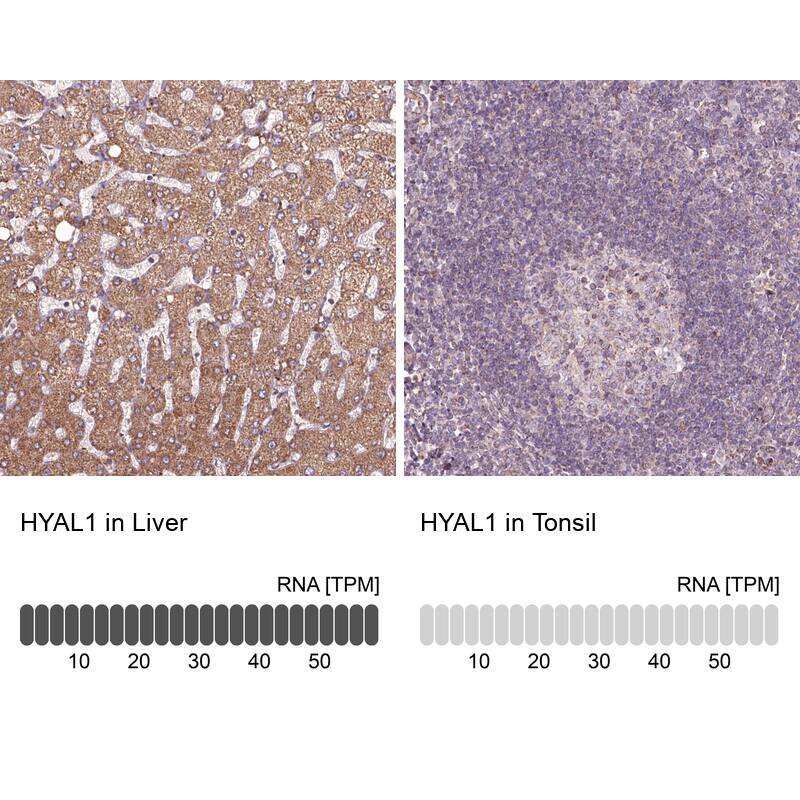Hyaluronidase 1/HYAL1 Antibody - BSA Free Immunohistochemistry-Paraffin: Hyaluronidase 1/HYAL1 Antibody - BSA Free [NBP1-83409]
