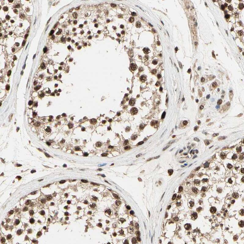 RBM25 Antibody - BSA Free Immunohistochemistry-Paraffin: RBM25 Antibody [NBP1-83418]