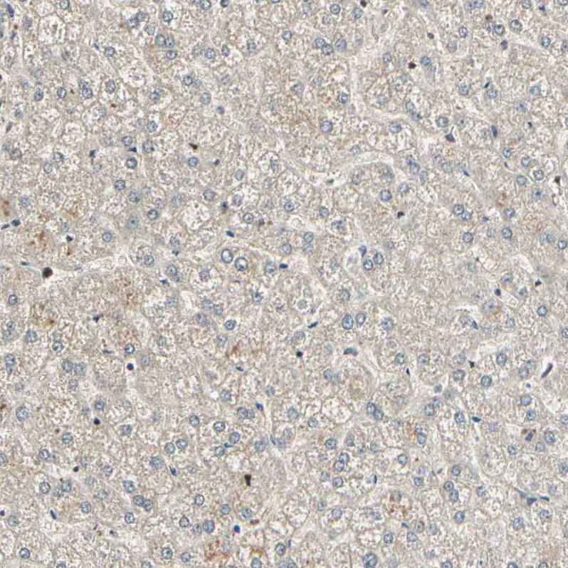 RBM25 Antibody - BSA Free Immunohistochemistry-Paraffin: RBM25 Antibody [NBP1-83418]