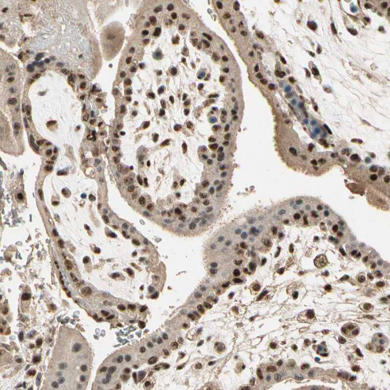 RBM25 Antibody - BSA Free Immunohistochemistry-Paraffin: RBM25 Antibody [NBP1-83418]