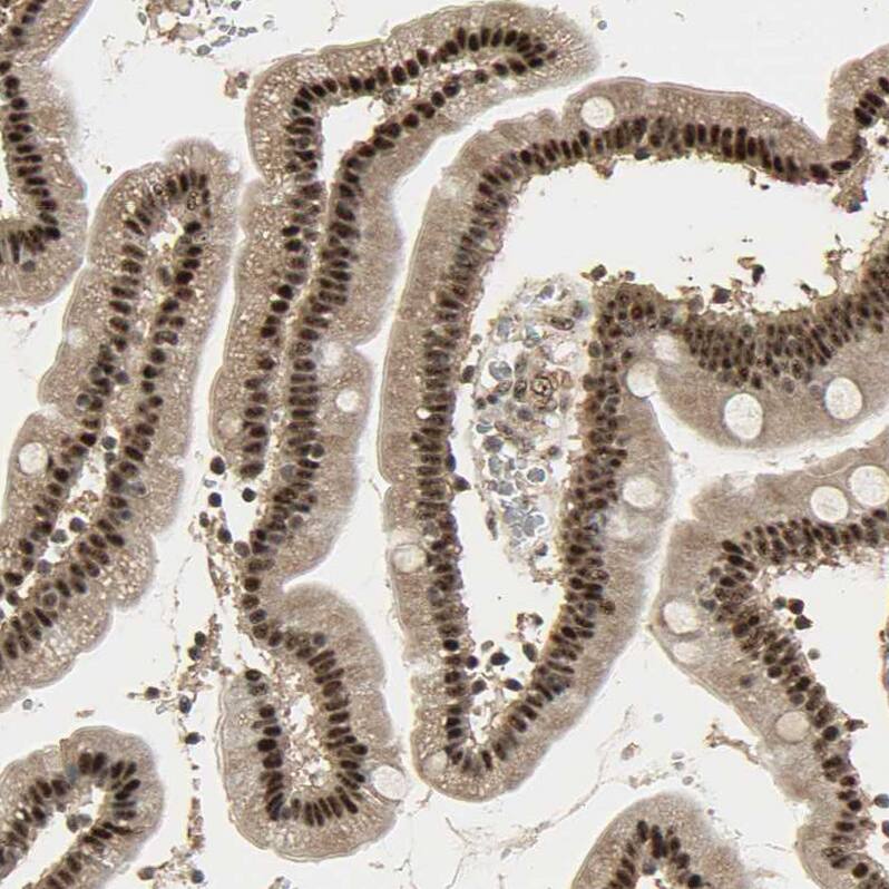 RBM25 Antibody - BSA Free Immunohistochemistry-Paraffin: RBM25 Antibody [NBP1-83418]