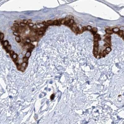 FRS3 Antibody - BSA Free Immunohistochemistry-Paraffin: FRS3 Antibody [NBP1-83420]