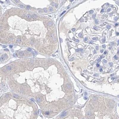FRS3 Antibody - BSA Free Immunohistochemistry-Paraffin: FRS3 Antibody [NBP1-83420]
