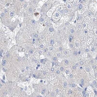 FRS3 Antibody - BSA Free Immunohistochemistry-Paraffin: FRS3 Antibody [NBP1-83420]