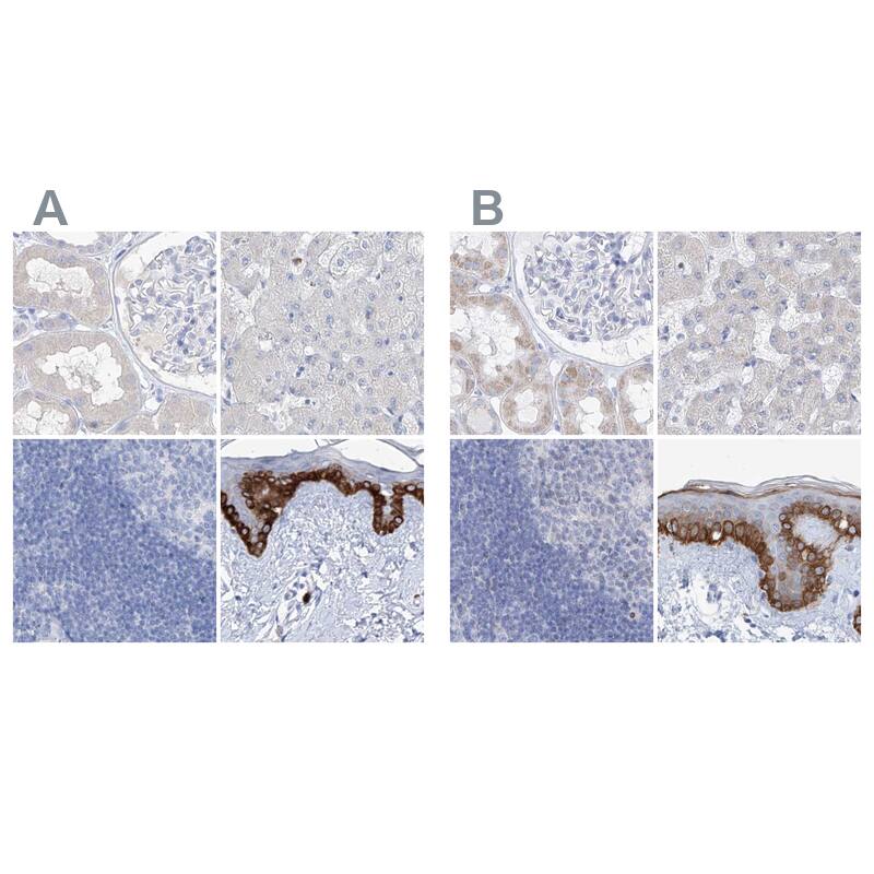 FRS3 Antibody - BSA Free Immunohistochemistry-Paraffin: FRS3 Antibody [NBP1-83420]
