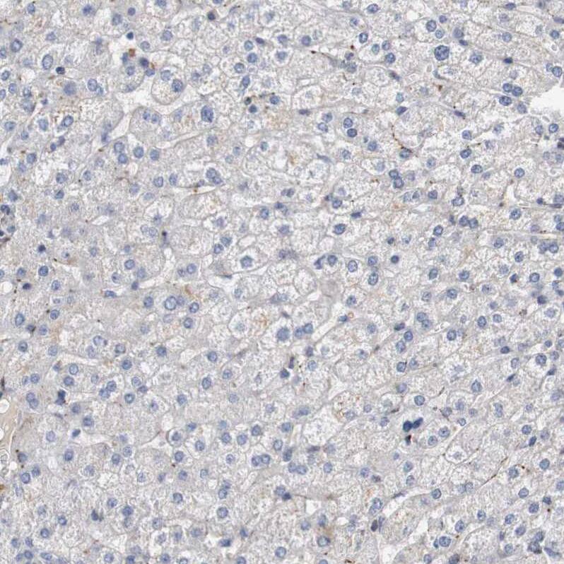 CYB561 Antibody - BSA Free Immunohistochemistry-Paraffin: CYB561 Antibody - BSA Free [NBP1-83422]