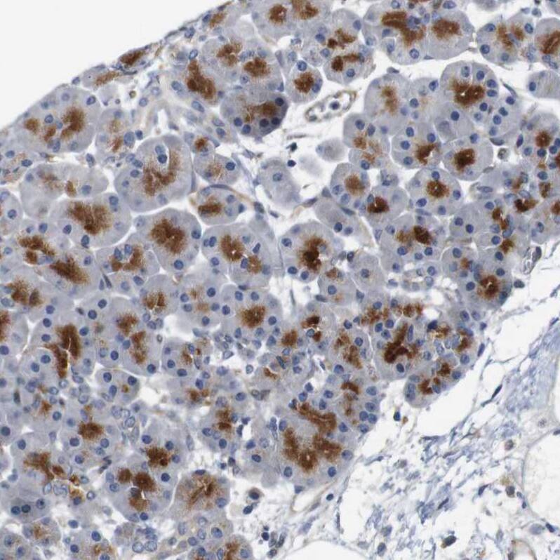 CYB561 Antibody - BSA Free Immunohistochemistry-Paraffin: CYB561 Antibody - BSA Free [NBP1-83422]