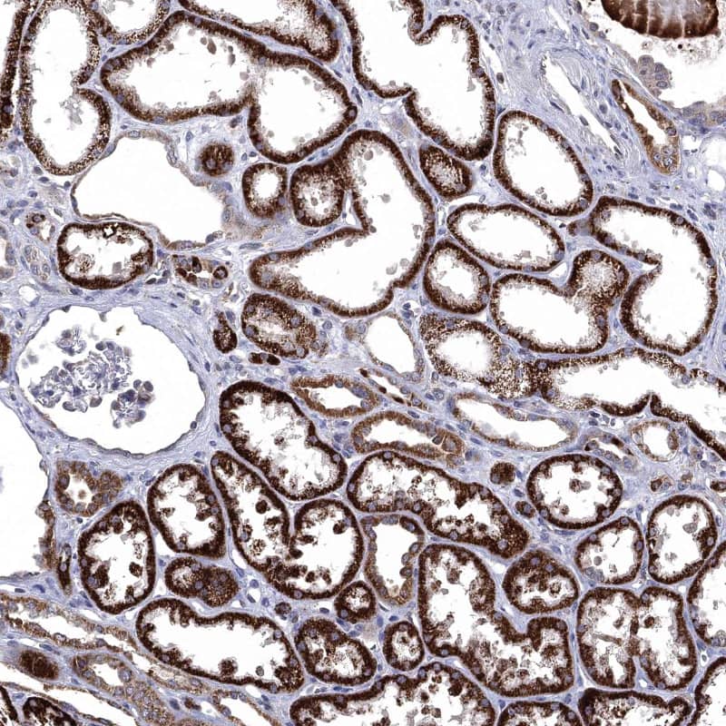 Fes Antibody - BSA Free Immunohistochemistry-Paraffin: Fes Antibody - BSA Free [NBP1-83429]