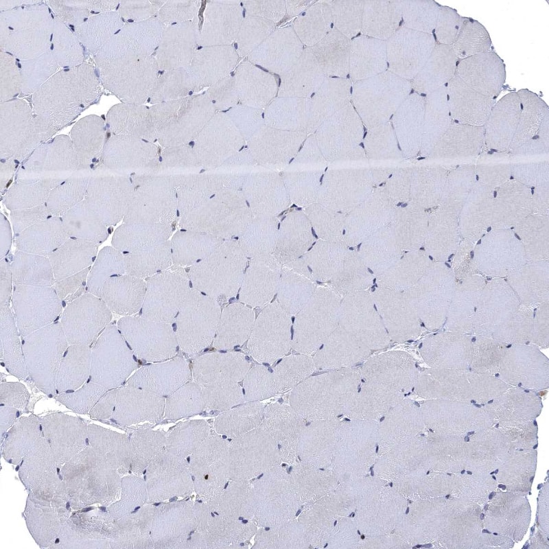 Fes Antibody - BSA Free Immunohistochemistry-Paraffin: Fes Antibody - BSA Free [NBP1-83429]