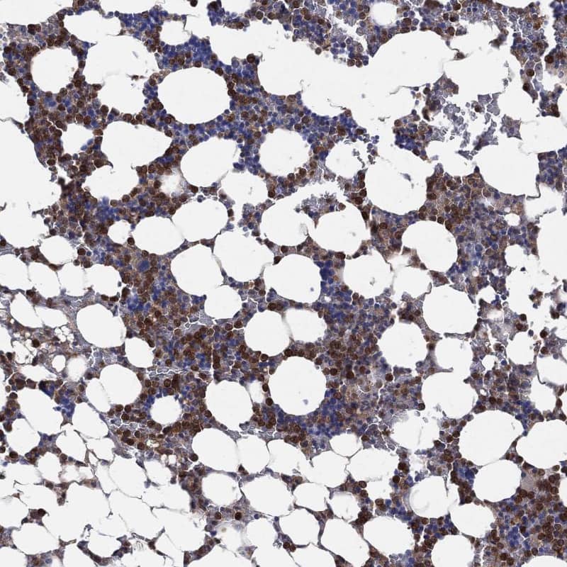 Fes Antibody - BSA Free Immunohistochemistry-Paraffin: Fes Antibody - BSA Free [NBP1-83429]