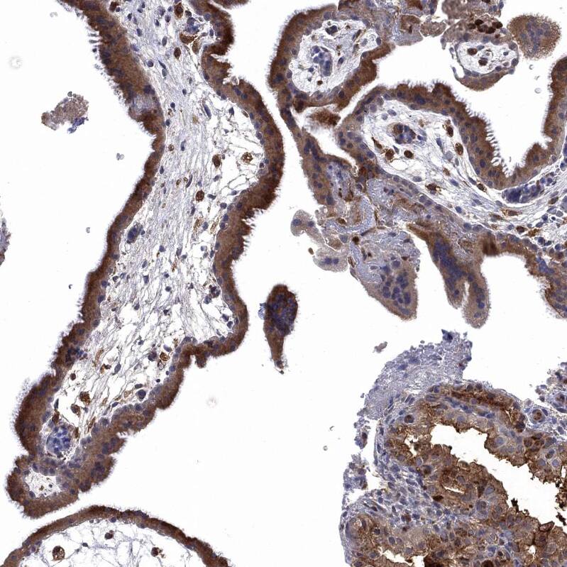 Fes Antibody - BSA Free Immunohistochemistry-Paraffin: Fes Antibody - BSA Free [NBP1-83429]