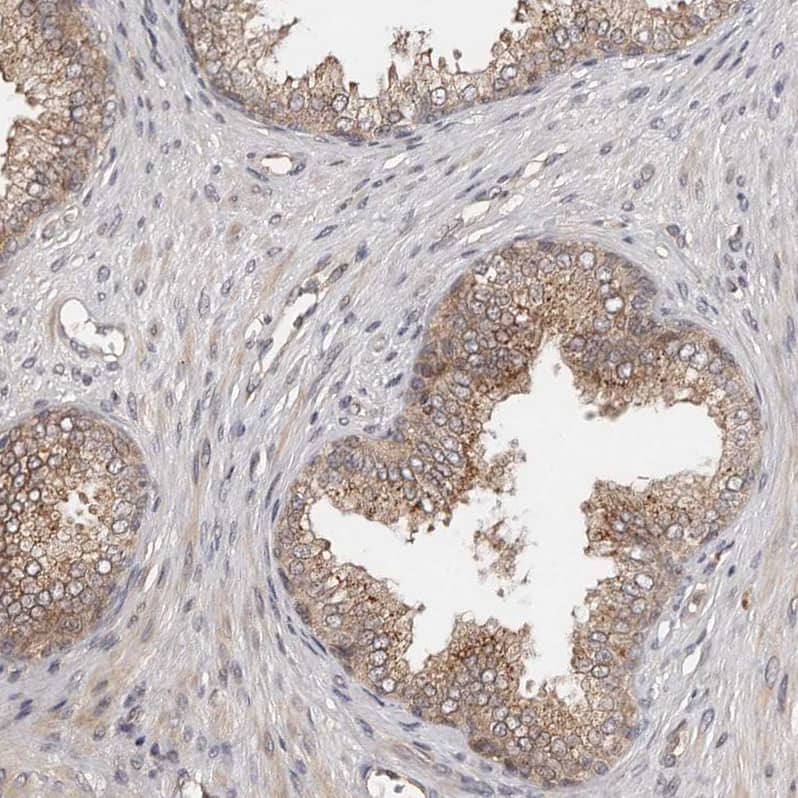 MDP1 Antibody - BSA Free Immunohistochemistry-Paraffin: MDP1 Antibody [NBP1-83431]