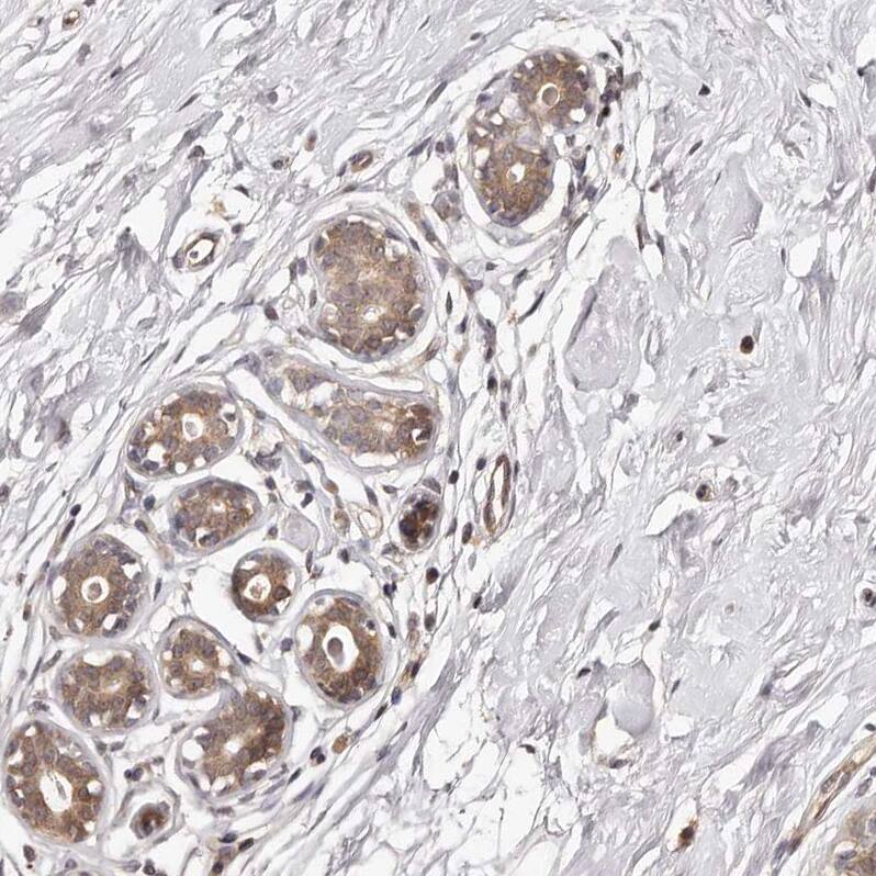 MDP1 Antibody - BSA Free Immunohistochemistry-Paraffin: MDP1 Antibody [NBP1-83431]