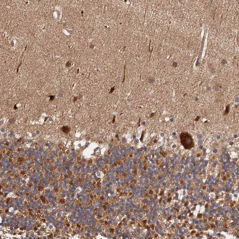 MDP1 Antibody - BSA Free Immunohistochemistry-Paraffin: MDP1 Antibody [NBP1-83431]