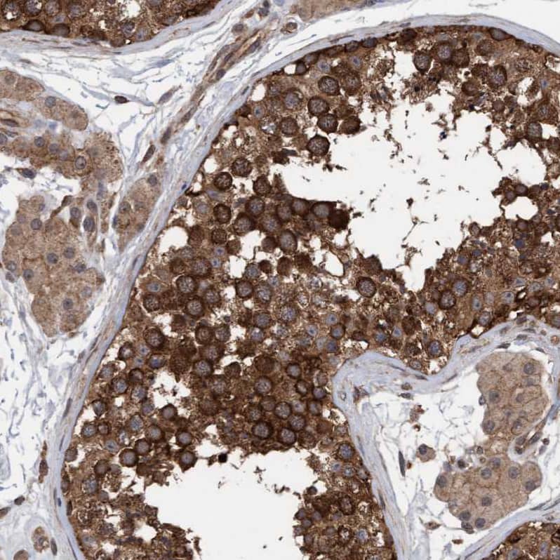 FXR2 Antibody - BSA Free Immunohistochemistry-Paraffin: FXR2 Antibody - BSA Free [NBP1-83432]