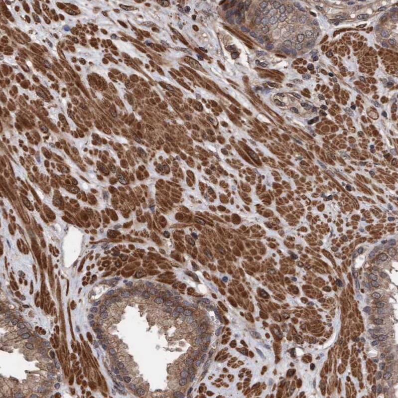 FXR2 Antibody - BSA Free Immunohistochemistry-Paraffin: FXR2 Antibody - BSA Free [NBP1-83432]