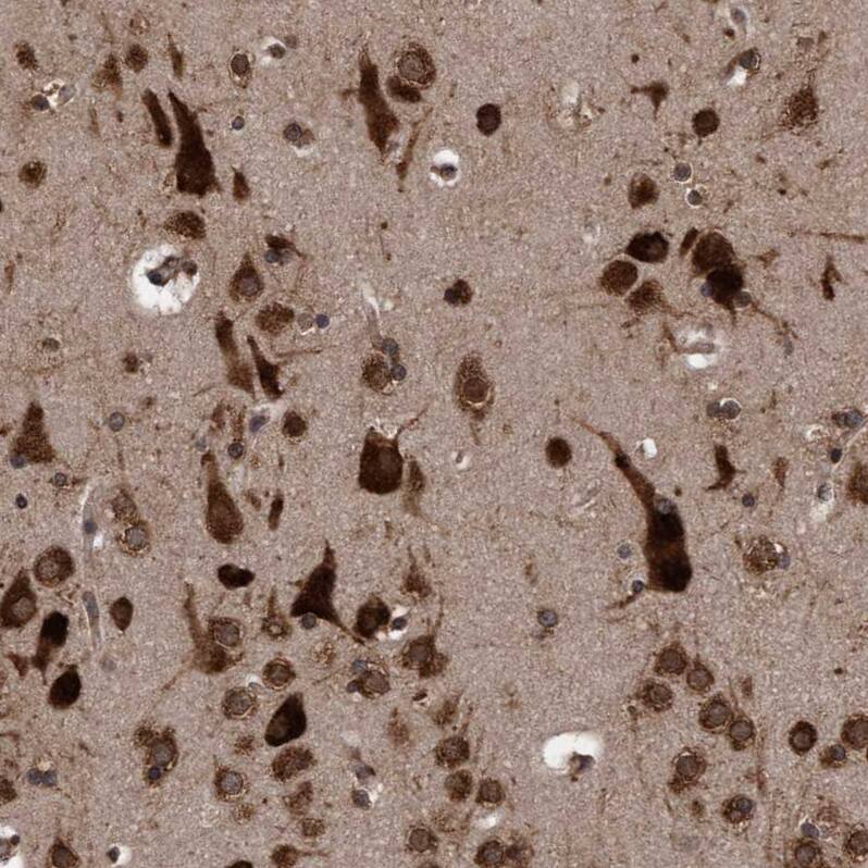 FXR2 Antibody - BSA Free Immunohistochemistry-Paraffin: FXR2 Antibody - BSA Free [NBP1-83432]